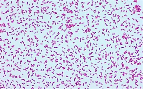 alcaligenes faecalis biochemical tests|Identification of Strains of Alcaligenes and Agrobacterium by a .